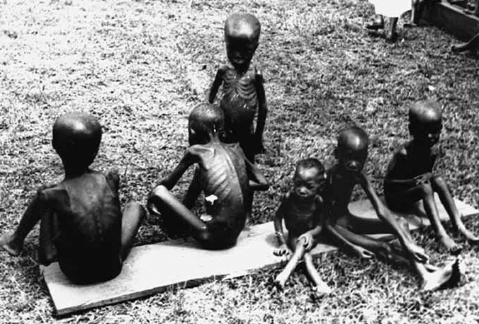 A black and white photograph shows six malnutrition children.